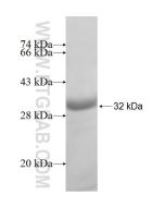 Recombinant human ARD1A protein Ag7406 proteintech