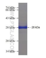 Recombinant human HSPB8 protein Ag7511 proteintech