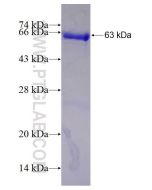 Recombinant human NSUN5 protein Ag7711 proteintech