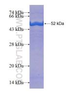 Recombinant human GMPPA protein Ag8068 proteintech