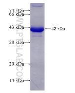 Recombinant human GCK protein Ag8116 proteintech