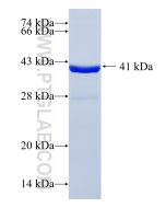 Recombinant human NFKBID protein Ag8139 proteintech