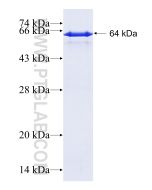 Recombinant human ALDH1A1 protein Ag8665 proteintech