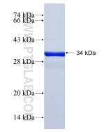 Recombinant human NDUFA2 protein Ag8675 proteintech
