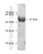 Recombinant human BHMT protein Ag8965 proteintech