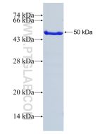 Recombinant human ARHGDIB protein Ag9078 proteintech
