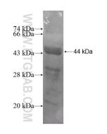 Recombinant human TBRG4 protein Ag9166 proteintech