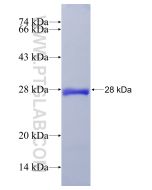 Recombinant human GNPNAT1 protein Ag9375 proteintech