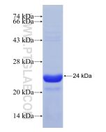 Recombinant human HN1L protein Ag9415 proteintech