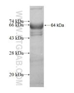 Recombinant human MOCOS protein Ag9487 proteintech