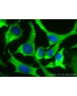 CoraLite® Plus 488-conjugated CLTB Polyclonal antibody CL488-10455 proteintech
