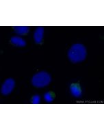 CoraLite® Plus 488-conjugated CENPJ Polyclonal antibody CL488-11517 proteintech