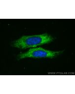 CoraLite® Plus 488-conjugated TFEB Polyclonal antibody CL488-13372 proteintech