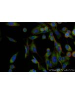 CoraLite® Plus 488-conjugated NEDD4L Polyclonal antibody CL488-13690 proteintech