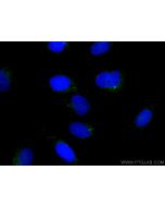 CoraLite® Plus 488-conjugated IFT88 Polyclonal antibody CL488-13967 proteintech