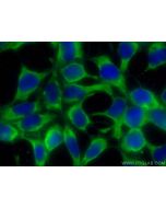 CoraLite® Plus 488-conjugated ALDH3A1 Polyclonal antibody CL488-15578 proteintech