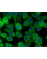 CoraLite® Plus 488-conjugated PHLDA1 Polyclonal antibody CL488-18263 proteintech