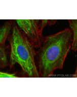 CoraLite® Plus 488-conjugated Cytokeratin 17 Polyclonal antibody CL488-18502 proteintech