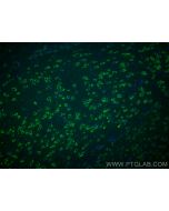 CoraLite® Plus 488-conjugated TMC1 Polyclonal antibody CL488-20718 proteintech