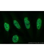 CoraLite® Plus 488-conjugated HNRNPA3 Polyclonal antibody CL488-25142 proteintech