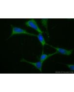CoraLite® Plus 488-conjugated Huntingtin Polyclonal antibody CL488-27206 proteintech