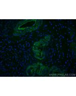 CoraLite® Plus 488-conjugated Transgelin 2 Monoclonal antibody CL488-60044 proteintech