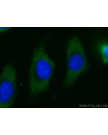CoraLite® Plus 488-conjugated MTAP Monoclonal antibody CL488-66706 proteintech