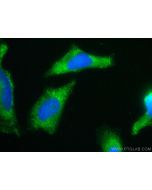 CoraLite® Plus 488-conjugated hIST1 Monoclonal antibody CL488-66989 proteintech