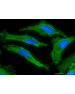 CoraLite® Plus 488-conjugated ALDH9A1 Monoclonal antibody CL488-67372 proteintech