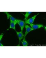CoraLite® Plus 488-conjugated MPI Monoclonal antibody CL488-68417 proteintech
