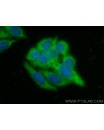 CoraLite® Plus 488-conjugated MMP2 Recombinant monoclonal antibody CL488-81515-2 proteintech