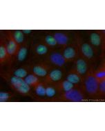 CoraLite® Plus 488-conjugated TOP2B Recombinant monoclonal antibody CL488-84049 proteintech