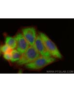 CoraLite® Plus 488-conjugated MTMR4 Recombinant monoclonal antibody CL488-84328 proteintech