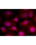 CoraLite®594-conjugated PFKFB3-Specific Polyclonal antibody CL594-13763 proteintech