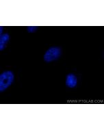 CoraLite®594-conjugated CEP164 Polyclonal antibody CL594-22227 proteintech