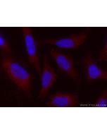 CoraLite®594-conjugated NCALD Monoclonal antibody CL594-66088 proteintech