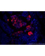 CoraLite®594-conjugated Mammaglobin A Monoclonal antibody CL594-66237 proteintech