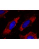 CoraLite®594-conjugated MTHFR Monoclonal antibody CL594-66612 proteintech