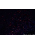 CoraLite®594-conjugated TSH Beta Monoclonal antibody CL594-66750 proteintech