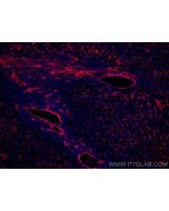CoraLite®594-conjugated VAP1/AOC3 Monoclonal antibody CL594-66834 proteintech