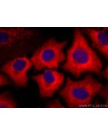 CoraLite®594-conjugated ACLY Monoclonal antibody CL594-67166 proteintech