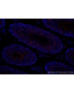 CoraLite®594-conjugated TEX14 Monoclonal antibody CL594-67982 proteintech