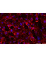 CoraLite®594-conjugated VE-cadherin/CD144 Recombinant monoclonal antibody CL594-83766-6 proteintech