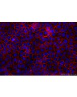 CoraLite®594-conjugated EPCAM/CD326 Recombinant monoclonal antibody CL594-84073-6 proteintech
