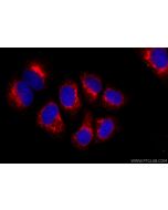 CoraLite®594-conjugated KTN1 Recombinant monoclonal antibody CL594-85681-4 proteintech