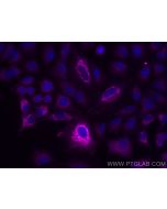 CoraLite® Plus 647-conjugated SOD2 Monoclonal antibody CL647-66474 proteintech