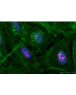 CoraLite® Plus 647-conjugated Ki-67 Recombinant monoclonal antibody CL647-84192-4 proteintech