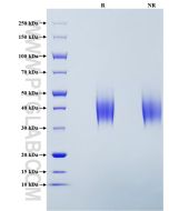 Recombinant Mouse CD86 protein (His Tag) Eg0802 proteintech