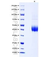 Recombinant Human TFPI protein (His Tag) Eg0855 proteintech