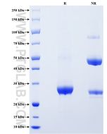 Recombinant Rat C-Reactive Protein/CRP protein (His Tag) Eg0942 proteintech